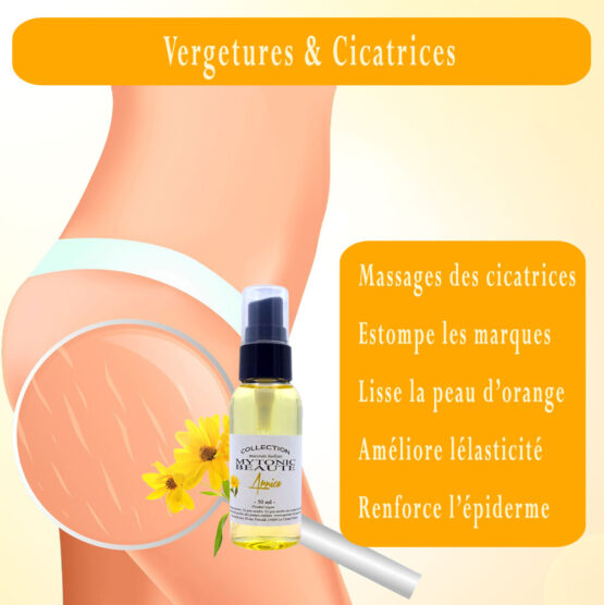 Macérat d'arnica contres les vergetures